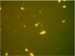 Science - Cryopreservation Of Bovine Semen With Some Additives For Augmenting Fertility