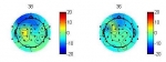 Engineering - Study Of The Cerebral Activity Modulation Due To The Radiation Produced By A Commercial Mobile Phone Conducted Using Eeg-tms